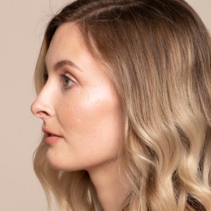 Chemical Peel Level 2