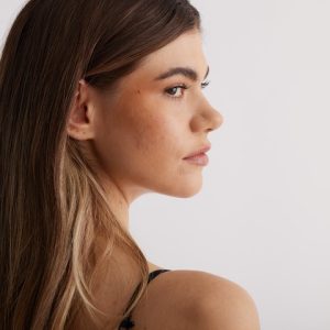 Kybella